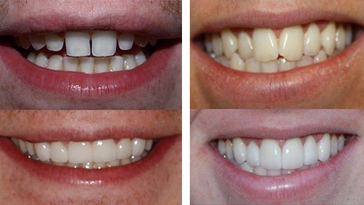 Cosmetic Dentistry Getaways: Transform Your Smile