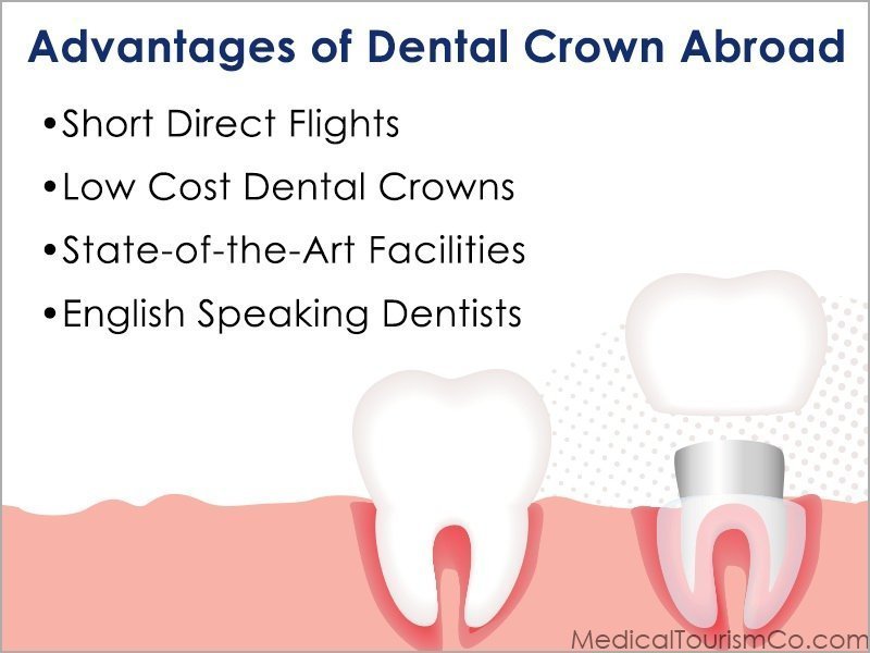 Dental Bridges And Crowns: Affordable Solutions Abroad