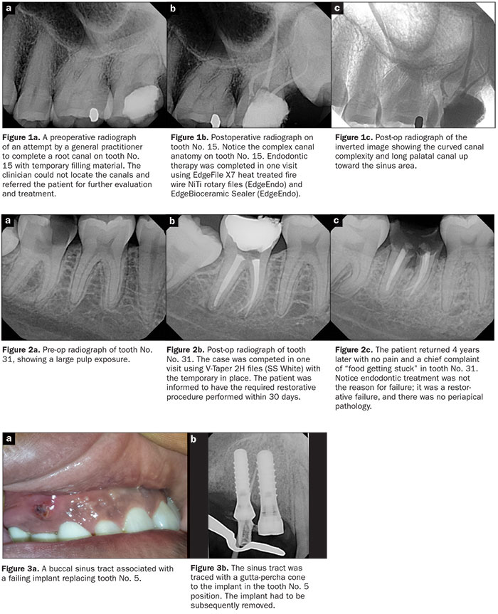 Dental Tourism For Complex Procedures: Case Studies And Success Stories