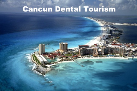 Dental Tourism Packages Mexico