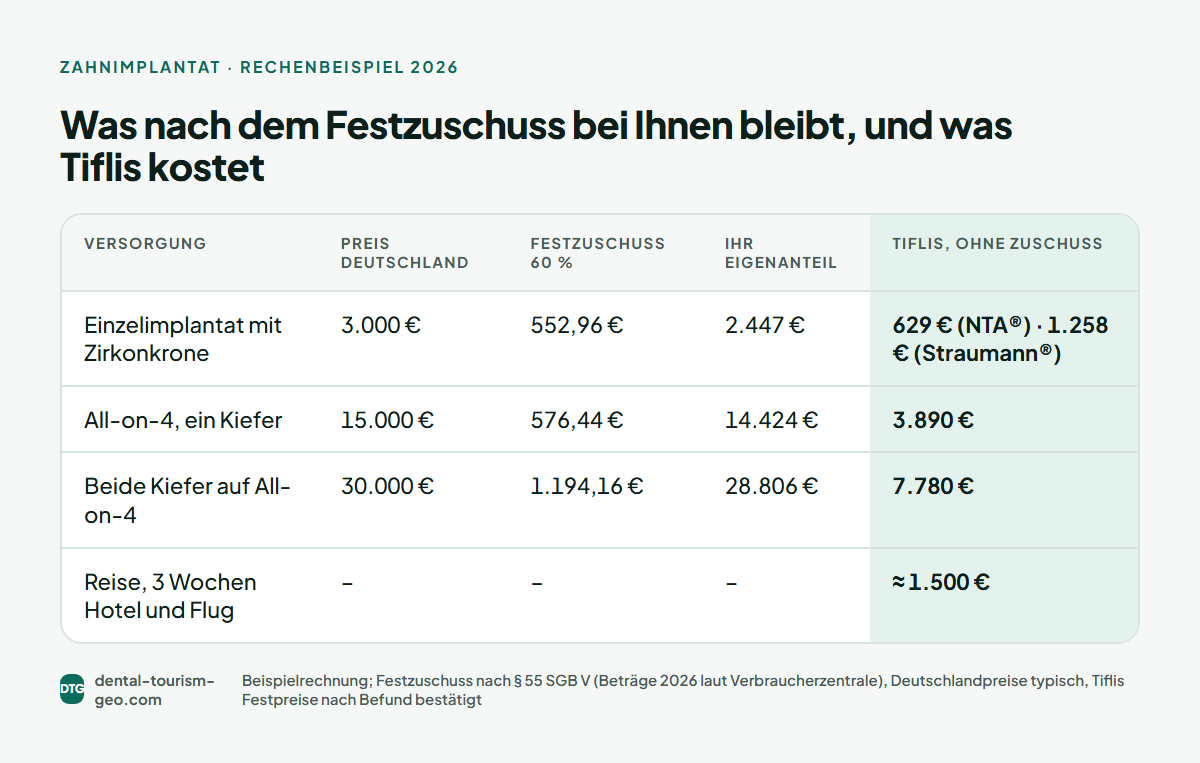Rechenbeispiel: Preis in Deutschland, Festzuschuss, Eigenanteil und Festpreis in Tiflis